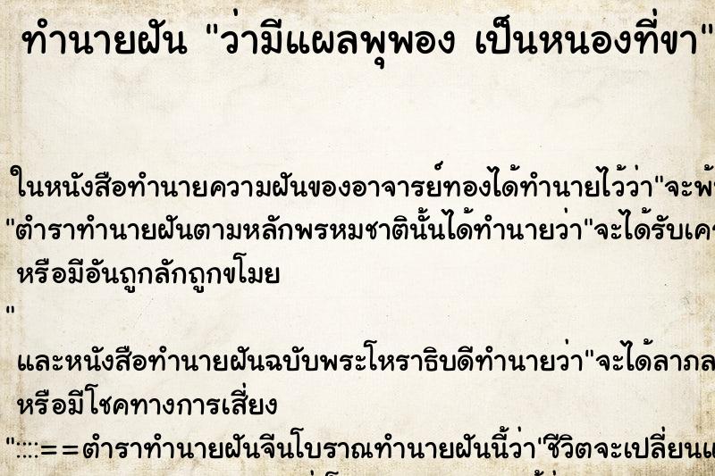 ทำนายฝัน ว่ามีแผลพุพอง เป็นหนองที่ขา ทำนายฝัน ว่ามีแผลพุพอง เป็นหนองที่ขา